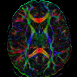 Brain Scan MRI in color