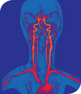 This magnetic resonance angiogram, developed at the Kirby Center, delineates arteries of the head and neck.