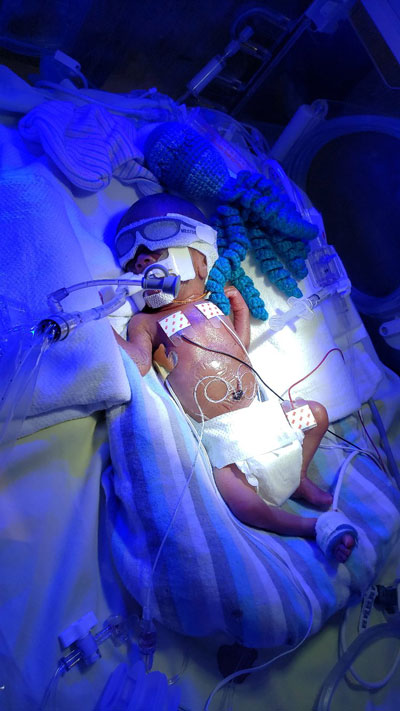 Alexander receiving treatment at the Infant Neurodevelopment Center as a newborn.