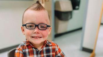 A young boy with Sturge-Weber syndrome smiles. 