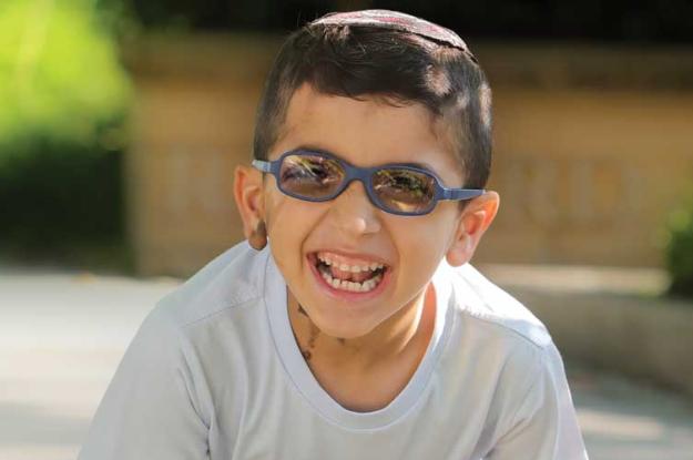 A young boy laughs and smiles while playing outside. He wears glasses and a kippa, and has a birthmark on his right ear and on the right side of his neck.